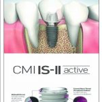 IS2-ACTIVE SURFACE IMPLANT
